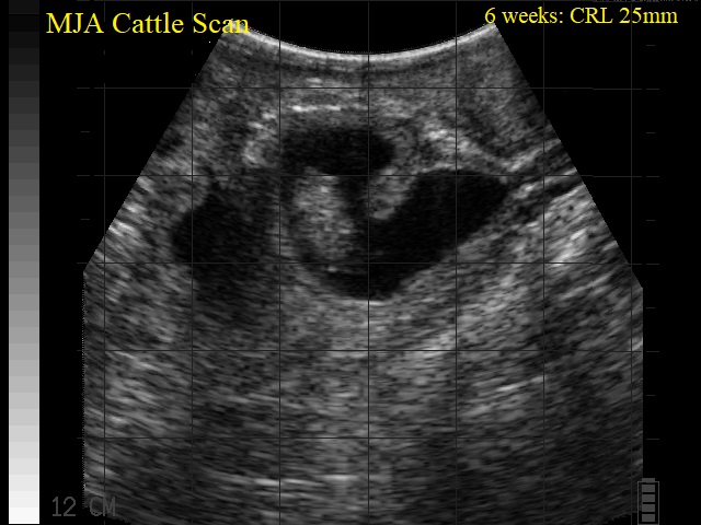 6 weeks CRL 25mm