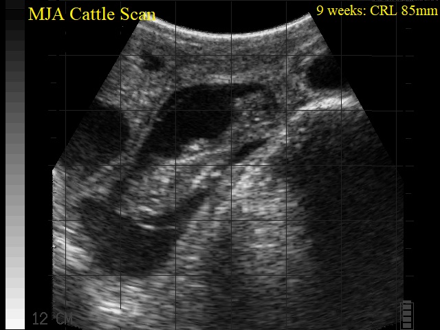 9 weeks CRL 85mm