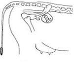 Early Pregnancy